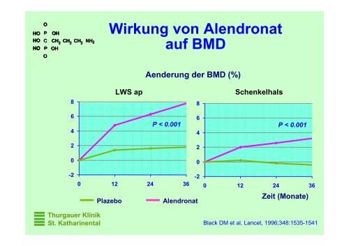 Osteoporose, State of the Art - Spital Thurgau AG