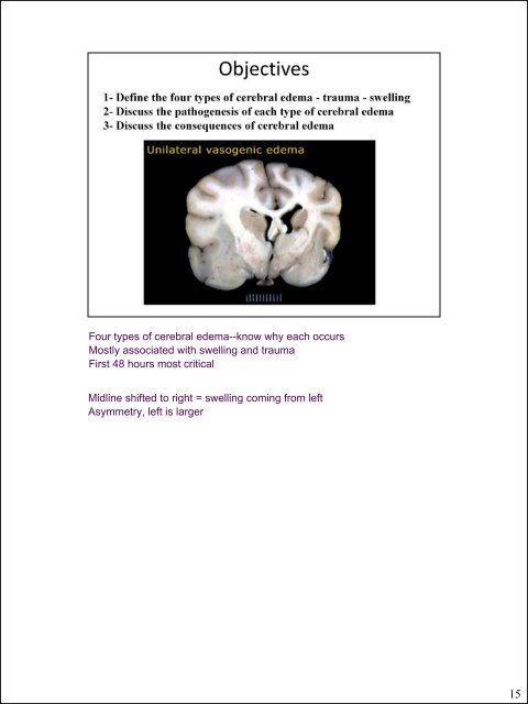 Glial cells (stromal cells) Oligodendrocytes ... - CSU PVM 2014