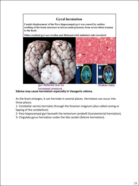 Glial cells (stromal cells) Oligodendrocytes ... - CSU PVM 2014