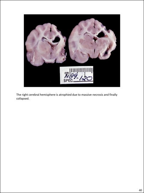 Glial cells (stromal cells) Oligodendrocytes ... - CSU PVM 2014