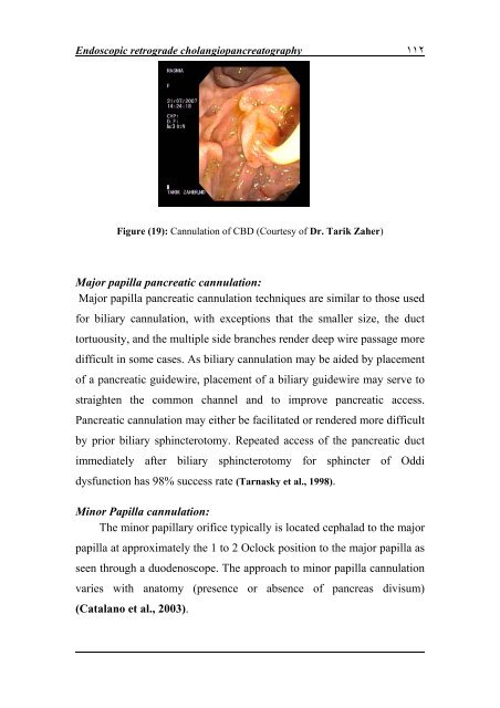 Parasites and Biliary stones