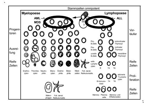 AML und MDS - Hämatologie und Onkologie Rostock