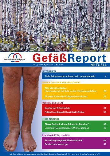 GefäßReport - Deutsche Gefäßliga eV