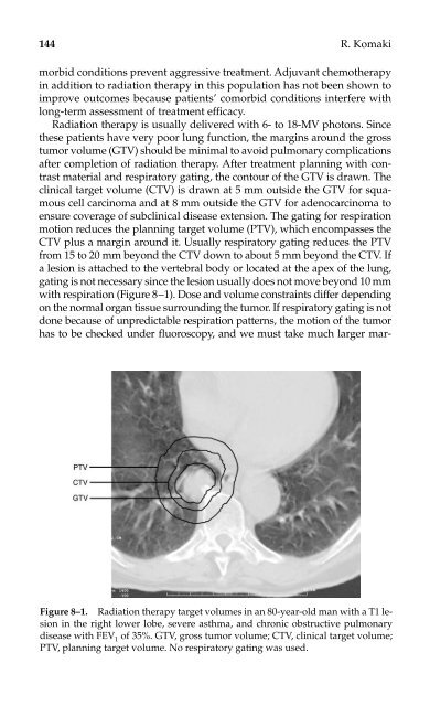 Lung Cancer.pdf