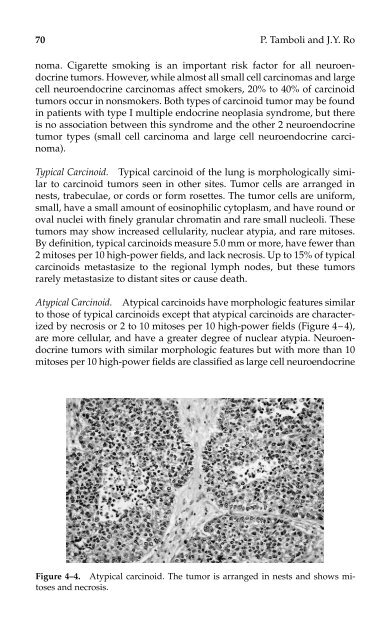 Lung Cancer.pdf