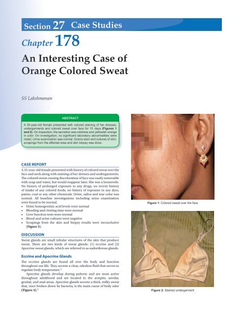 An Interesting Case of Orange Colored Sweat - The Association of