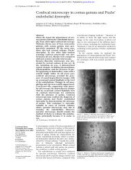 Confocal microscopy in cornea guttata and Fuchs' endothelial ...