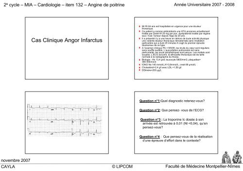 Cas Clinique Angor Infarctus - Faculté de médecine de Montpellier