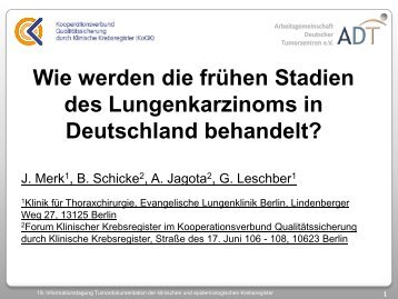 Altersverteilung, NSCLC, Stadium I/II