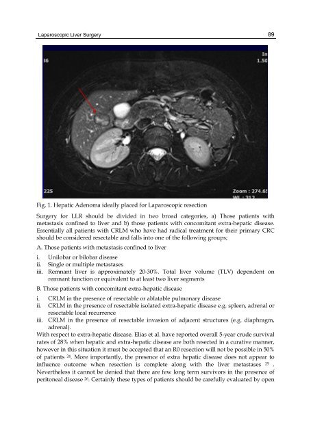 UPDATED TOPICS IN MINIMALLY INVASIVE ABDOMINAL SURGERY