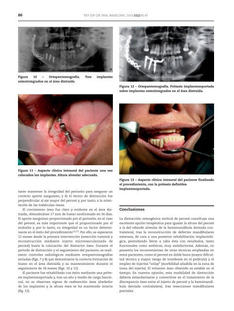 Cirugía Oral y Maxilofacial - SciELO España