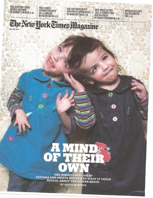 Tatiana Amp Krista Hogan Conjoined Twins