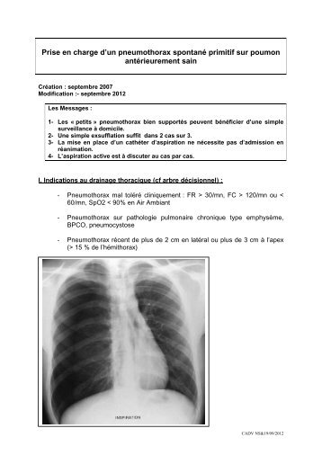 Prise en charge d'un pneumothorax spontané primitif sur poumon ...