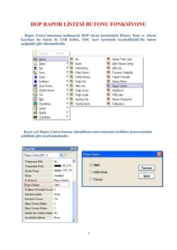 DOP RAPOR LĐSTESĐ BUTONU FONKSĐYONU