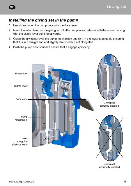 APPLIX Smart - Enteral Feeding Pump - Instructions for use