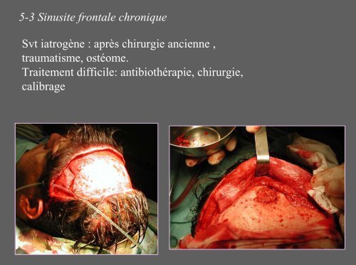 sinus et angines dcem 2