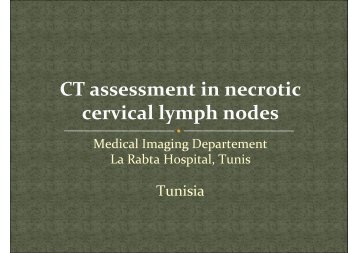 CT assessment in necrotic cervical lymph nodes