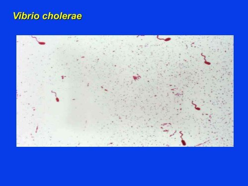 V. cholerae - Filippo Pacini