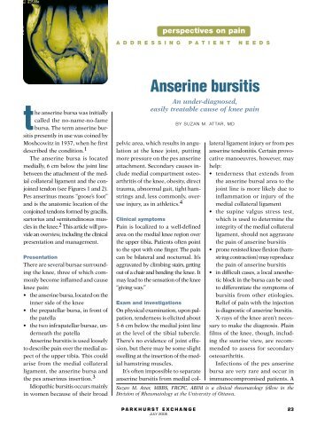 Anserine bursitis