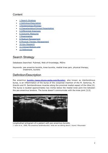 Pes anserinus bursitis