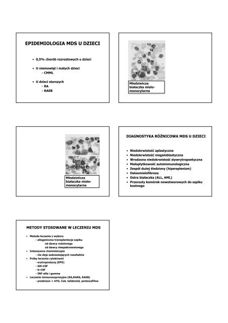 WACHOWIAK-J-Białaczki, zespół mielodysplastyczny - Klinika ...