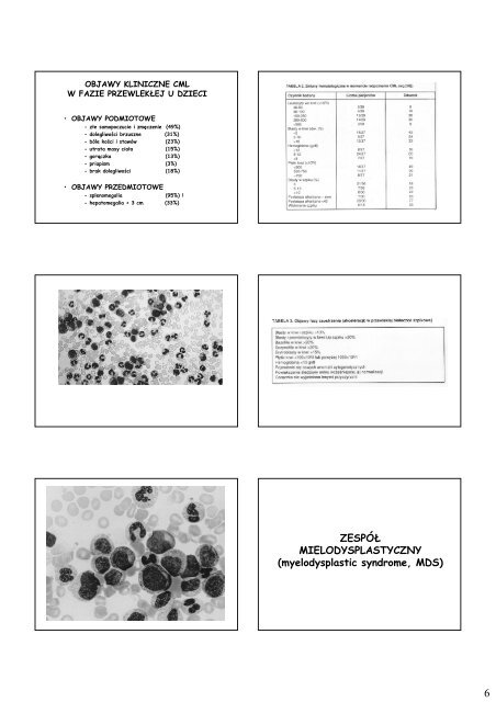 Choroby rozrostowe układu krwiotwórczego - Klinika Onkologii ...