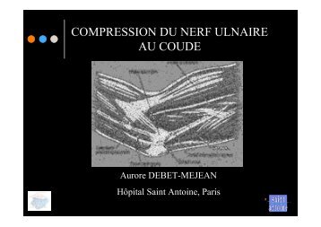 COMPRESSION DU NERF ULNAIRE AU COUDE - ClubOrtho.fr