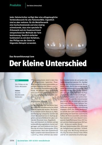 Der kleine Unterschied - Dentalplus Lab