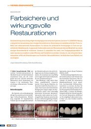 Fachartikel zu Ceramco iC von Juergen Gebhardt - dentsply ...