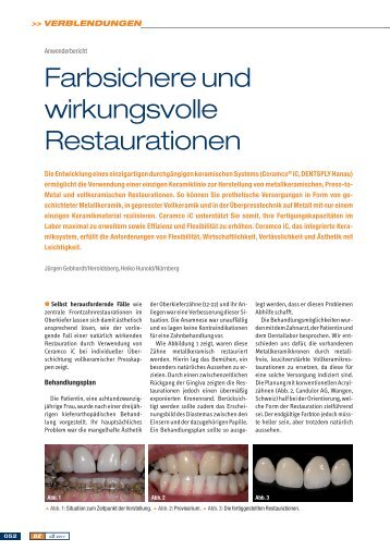 Fachartikel zu Ceramco iC von Juergen Gebhardt - dentsply ...