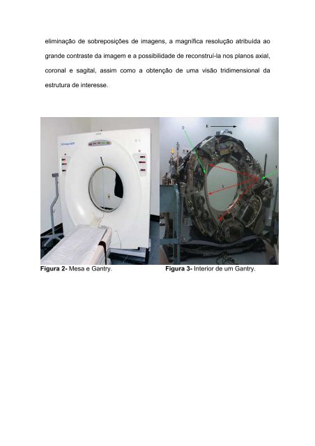 avaliação em tomografia computadorizada por feixe cônico ... - Unicid