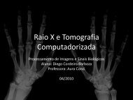 Raio X e Tomografia Computadorizada