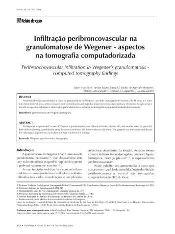 Infiltração peribroncovascular na granulomatose de Wegener - Sopterj