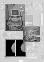 Medição de Assimetria em imagens mamográficas - Unorp
