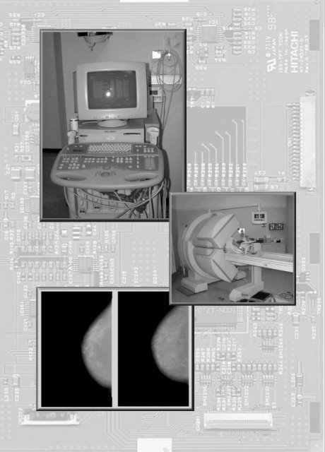 Medição de Assimetria em imagens mamográficas - Unorp