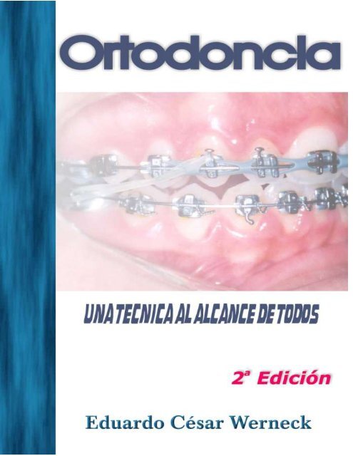 La agenesia dental se transmitirá La agenesia dental se transmitirá