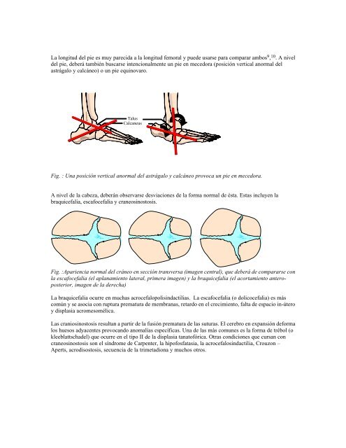 La valoración del feto con displasia esquelética - SonoWorld