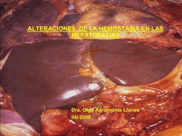 Alteraciones complejas de la hemostasia en las hepatopatías