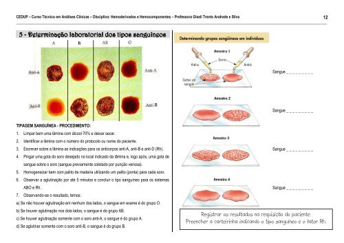 Hemocomponentes e Hemoderivados.pdf