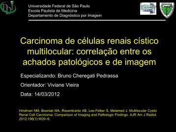 Carcinoma de células renais cístico multilocular ... - (DDI) - UNIFESP