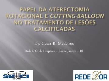 Papel da aterectomia rotacional e cutting-balloon no - SBHCI