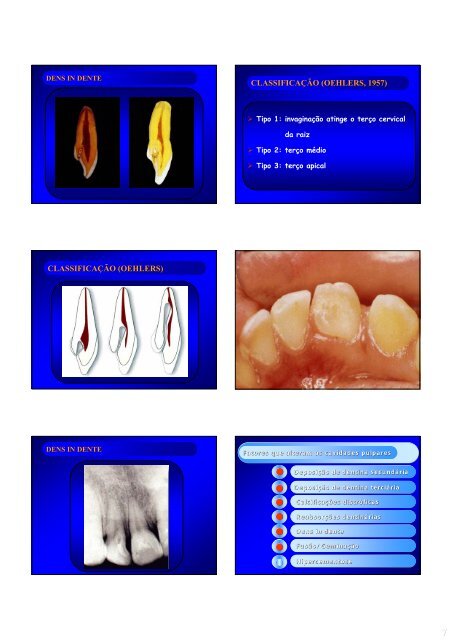 Aspectos de interesse à endodontia - endodontia.com.br