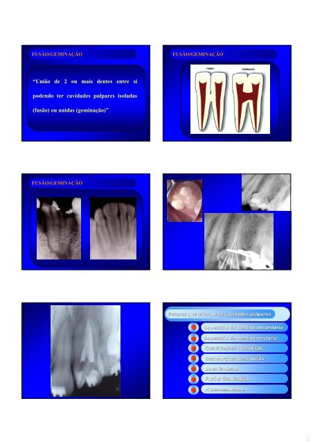 Aspectos de interesse à endodontia - endodontia.com.br