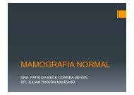 MAMOGRAFIA NORMAL - Sidi