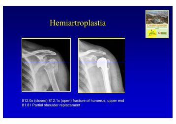 Cirurgia JoelhoOmbro 3 - Portal da Codificação Clínica e dos GDH