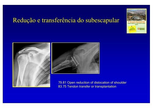 Cirurgia JoelhoOmbro 3 - Portal da Codificação Clínica e dos GDH