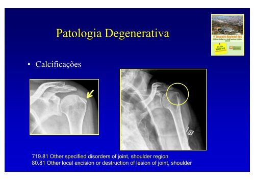 Cirurgia JoelhoOmbro 3 - Portal da Codificação Clínica e dos GDH