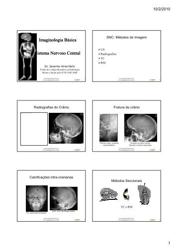 Imaginologia básica-10-Neuro e CP - Linea Diagnóstico por Imagem