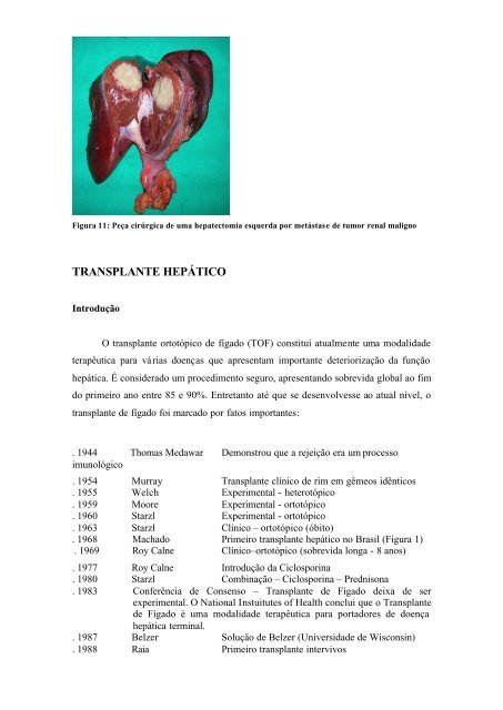 Cirurgia Fígado Completo - Drorlandotorres.com.br