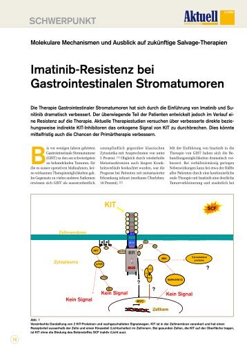 Übersichtsartikel zur Behandlung bei Imatinib-Resistenz ...